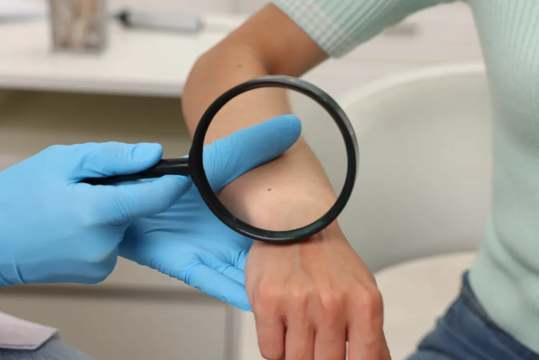 Dermatologie: Hautuntersuchung mit Lupe